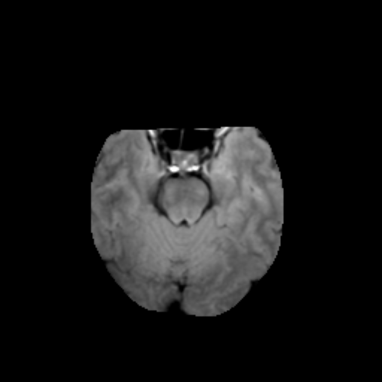 CS_4942